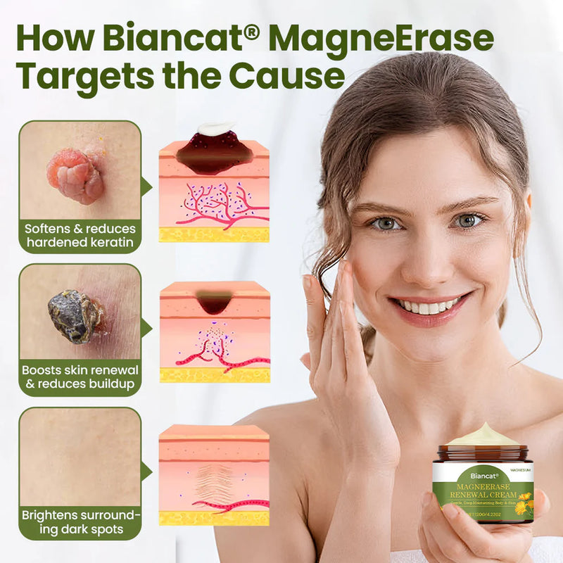 MagneErase Renewal Cream