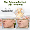 MagneErase Renewal Cream