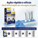 ChillErase - Spray para remoção de verrugas