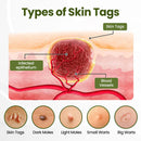 MagneErase Renewal Cream