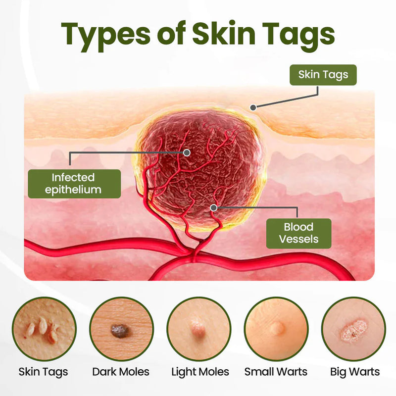 MagneErase Renewal Cream