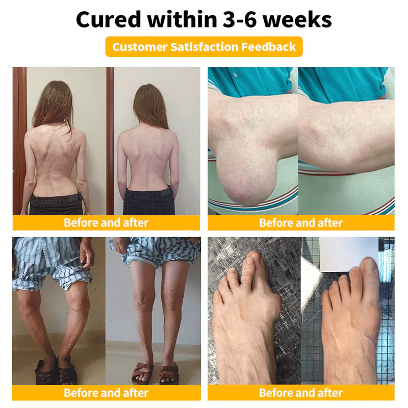 BeeRx BeeThera | Alívio com infusão de veneno de abelha para ossos e articulações