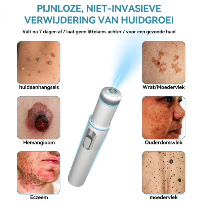 Caneta a laser Bikenda - EXTERMINADORA DE VERRUGAS