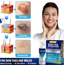 SPRAY SKIN TAG REMOVER