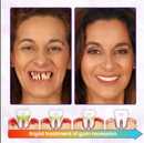 BeeRenew Advanced Gum Healing