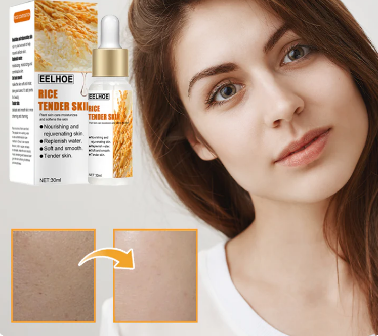 RICE TENDER SKIN