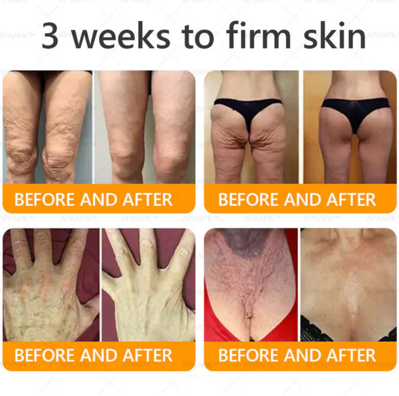 Royal Venom Cream | Firmador de pele