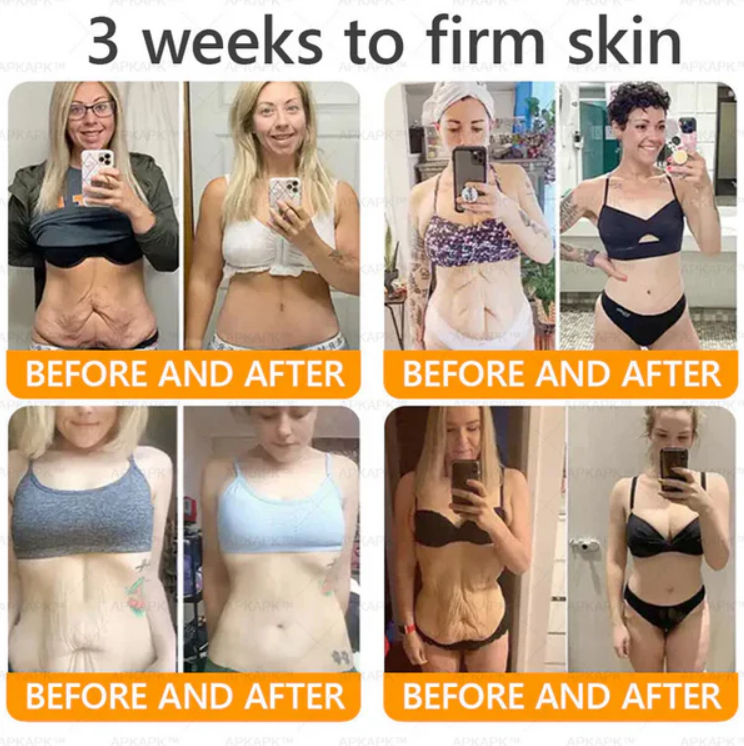 Royal Venom Cream | Firmador de pele