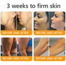 Royal Venom Cream | Firmador de pele