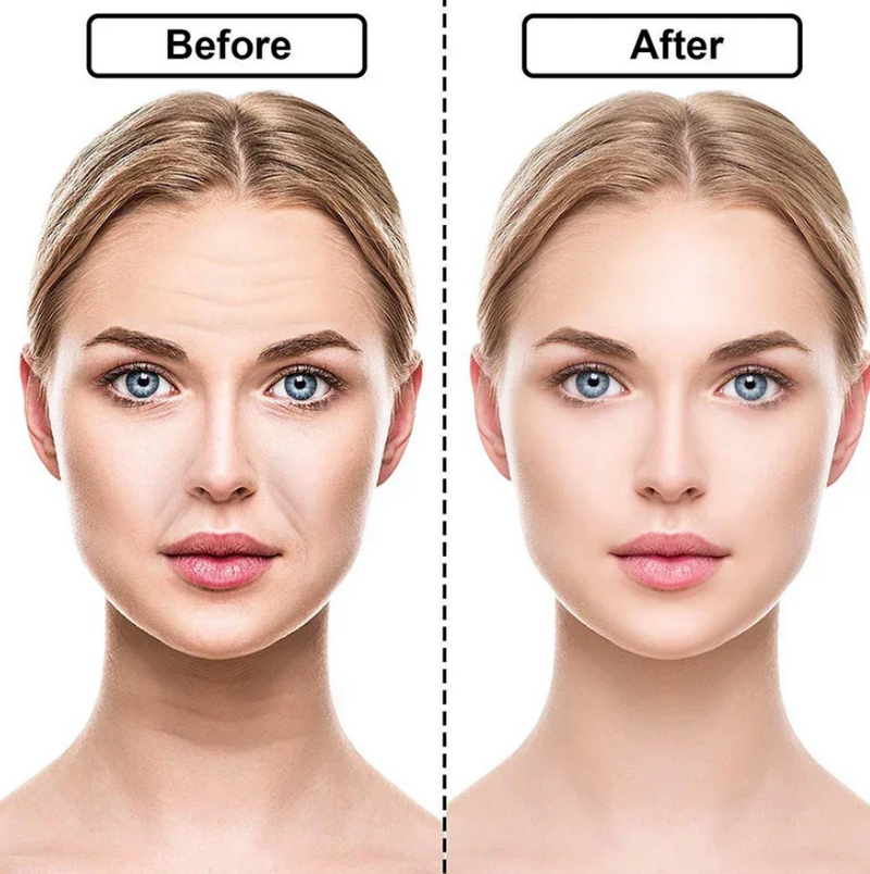 Kit Rejuvene Clean - Adesivos Anti-Rugas das famosas (Reutilizável por até 60 vezes)