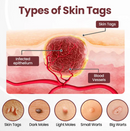 Creme Renovador de Dupla Ação KeraErase