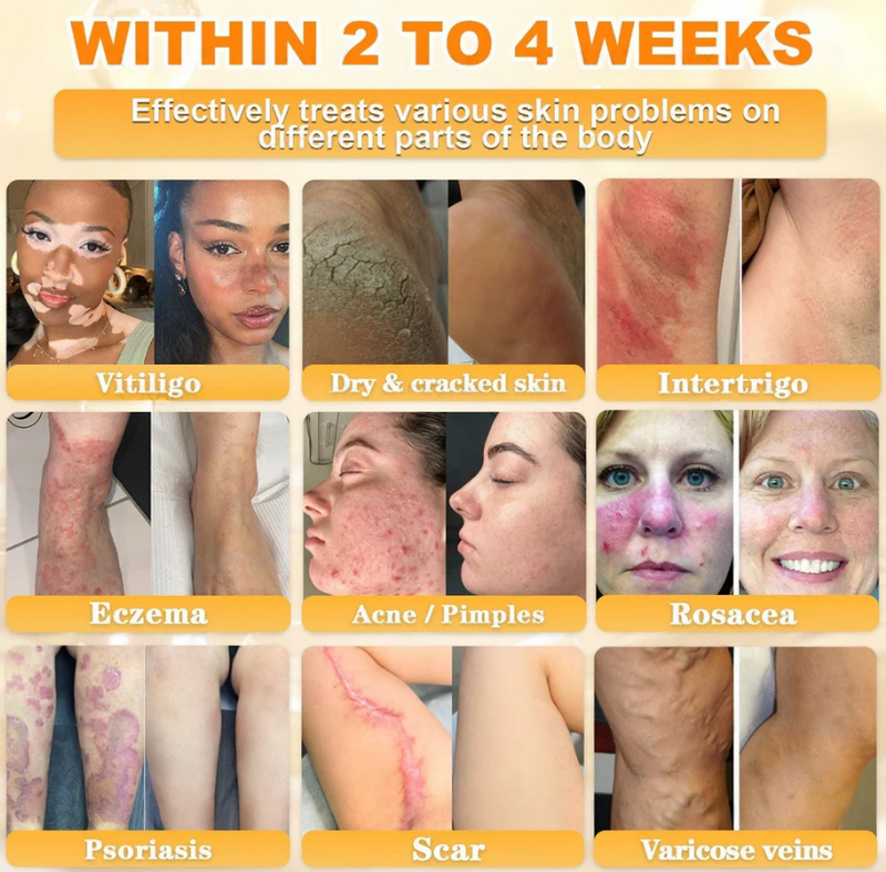 BEE VENOM - EFEITO LIFTING