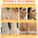 BEE VENOM - EFEITO LIFTING