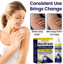 WartErase Cryo Freeze Spray