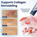 DermaFix Texture Repair Gel