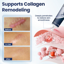 DermaFix Texture Repair Gel