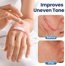 DermaFix Texture Repair Gel