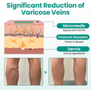 Adesivo para varizes - LegRenew