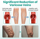 Adesivo para varizes - LegRenew