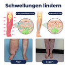 SWELLRELIEF