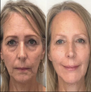 COLLAGEN FULLERENE - Sua pele 10 anos mais Jovem