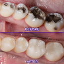 VIOLETX - CHEGA DE DENTES AMARELADOS