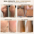 Gold Sculpt - ACABE COM A CELULITE , ESTRIAS E FLACIDEZ