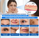 Tratamento Antirrugas com Botox e PDRN – Creme Lifting e Firmador