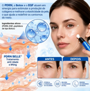 Tratamento Antirrugas com Botox e PDRN – Creme Lifting e Firmador