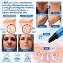 Tratamento Antirrugas com Botox e PDRN – Creme Lifting e Firmador