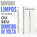 EarVision Pro™ - Veja o que há dentro dos seus ouvidos!