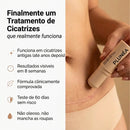 PLUNÉA - O FIM DAS MARCAS E MANCHAS CAUSADAS PELA ACNE