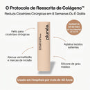 PLUNÉA - O FIM DAS MARCAS E MANCHAS CAUSADAS PELA ACNE