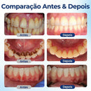 BeeTakt - SEUS DENTES RENOVADOS