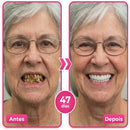 Thismile NH-10 - CLAREADOR DENTAL
