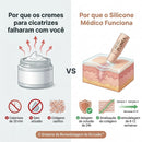 PLUNÉA - O FIM DAS MARCAS E MANCHAS CAUSADAS PELA ACNE