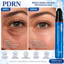 Tratamento Antirrugas com Botox e PDRN – Creme Lifting e Firmador