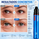 Tratamento Antirrugas com Botox e PDRN – Creme Lifting e Firmador