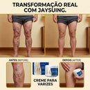 CREME VARICOSE VEINS - EXTERMINADOR DE VARIZES
