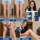 CREME VARICOSE VEINS - EXTERMINADOR DE VARIZES