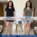 CREME VARICOSE VEINS - EXTERMINADOR DE VARIZES