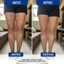 CREME VARICOSE VEINS - EXTERMINADOR DE VARIZES