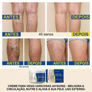 CREME VARICOSE VEINS - EXTERMINADOR DE VARIZES