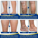 CREME VARICOSE VEINS - EXTERMINADOR DE VARIZES