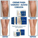 CREME VARICOSE VEINS - EXTERMINADOR DE VARIZES